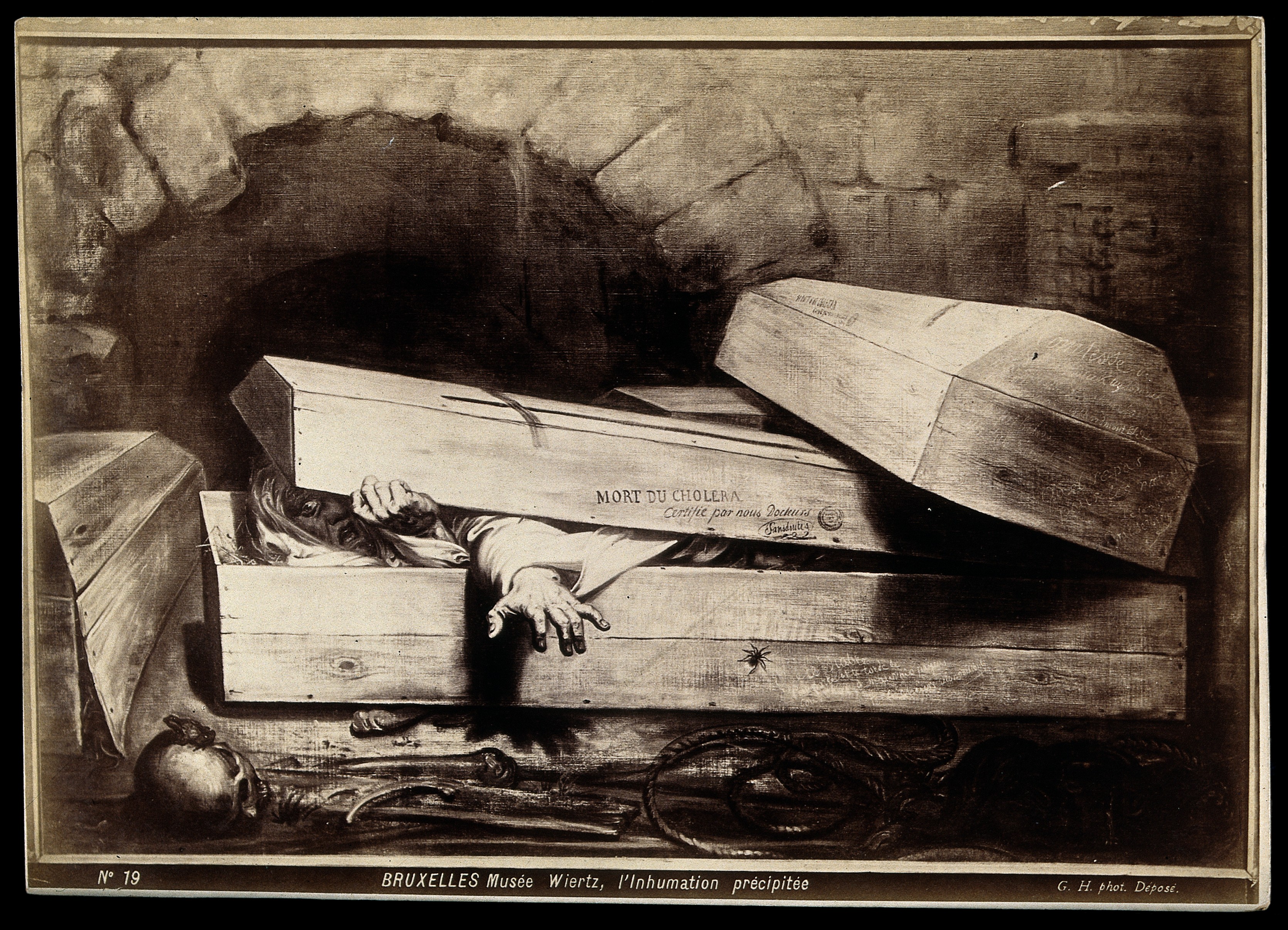 Antoine Wiertz: The Premature Buria. 1854/Wikimedia Commons