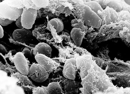 Бактерии Yersinia pestis — возбудители чумы. Изображение сканирующего электронного микроскопа / Национальный институт аллергии и инфекционных заболеваний (NIAID) / Wikimedia Commons