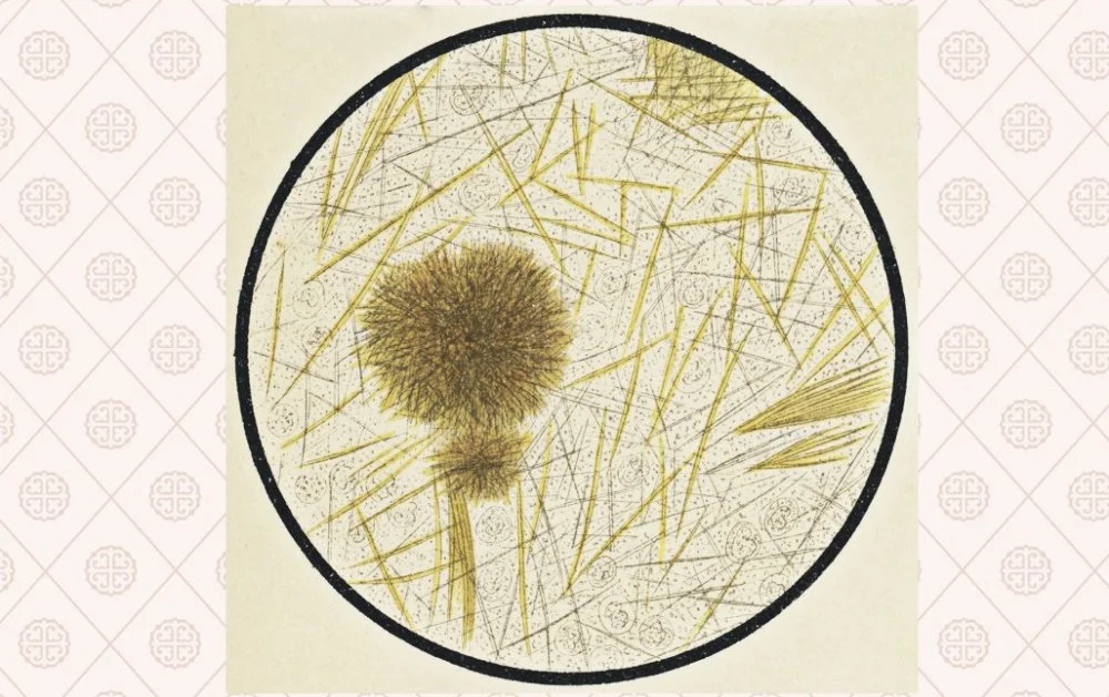 Кркристалисталлы мочевой кислоты под микроскопом. Рисунок 19 века / Getty