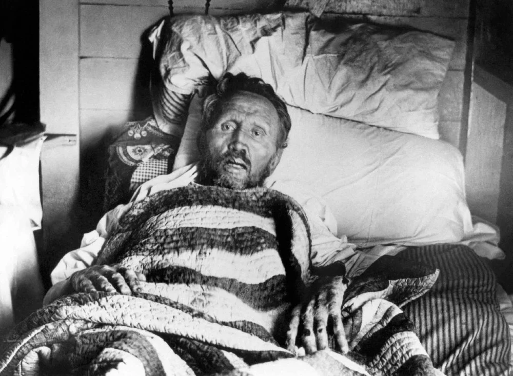 Father Damien (1840–1889), Roman Catholic missionary to lepers on the island of Molokai in the Sandwich (Hawaiian) Islands, on his deathbed after contracting leprosy from the people to whom he ministered. Photo presumably taken by Dr. Sydney B. Swift on Palm Sunday, April 14, 1889, the day before Damien died/Alamy